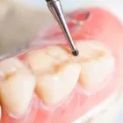 Yrityksen 2 kuva HAMMASLABORATORIO AKI PÄRNÄNEN Hammasproteesien, keinohampaiden ym. valmistus  Kuopio 15