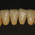 Yrityksen 6 kuva HAMMASLABORATORIO CERATECH / KRUUNUHAMMAS OY -SEPPO KÄRKKÄINEN  Kuopio 15