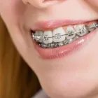 Yrityksen 1 kuva HAMMASLABORATORIO VIPHAMMAS OY Hammasproteesien, keinohampaiden ym. valmistus  Espoo 18