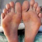 Yrityksen 5 kuva JALKAHOITOLA SAARESSA Muu terveyspalvelu  Oulu 14