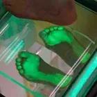 Yrityksen 2 kuva JALKATERAPIA PODOSTEP Muu terveyspalvelu  Savonlinna 04