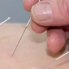 Yrityksen 2 kuva PÄIVÄNKAKKARANNE OY PÄIVÄNPAISTE Fysioterapia  Kuusamo 14