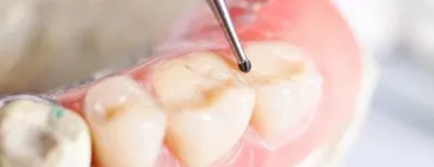 Yrityksen 2 kuva HAMMASLABORATORIO AKI PÄRNÄNEN Hammasproteesien, keinohampaiden ym. valmistus  Kuopio 15