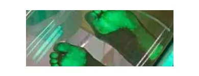 Yrityksen 2 kuva JALKATERAPIA PODOSTEP Muu terveyspalvelu  Savonlinna 04